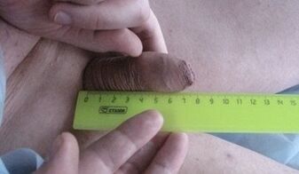 Messung der Penisgröße